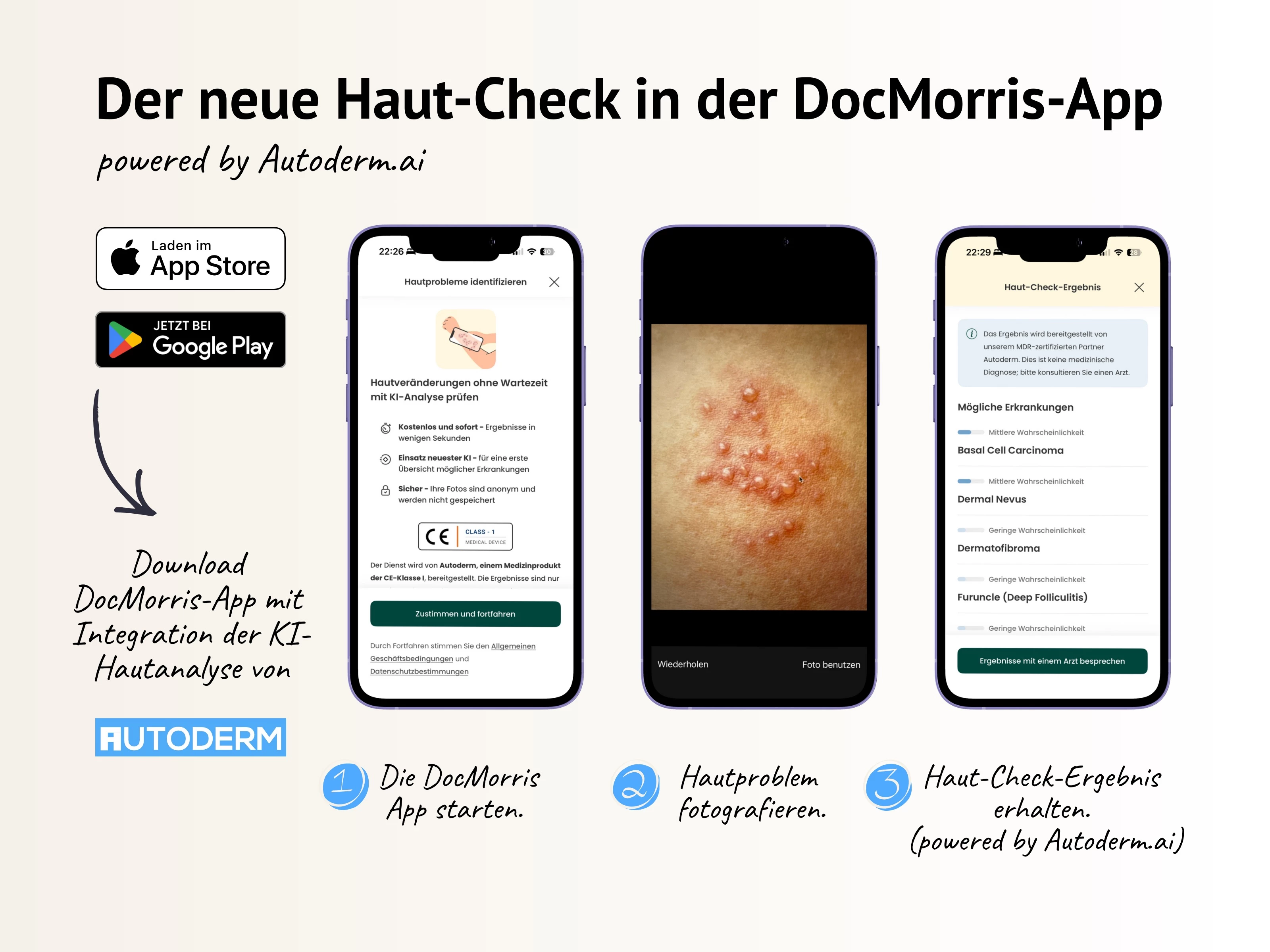 Autoderm KI-Hautanalyse: Innovation bei DocMorris