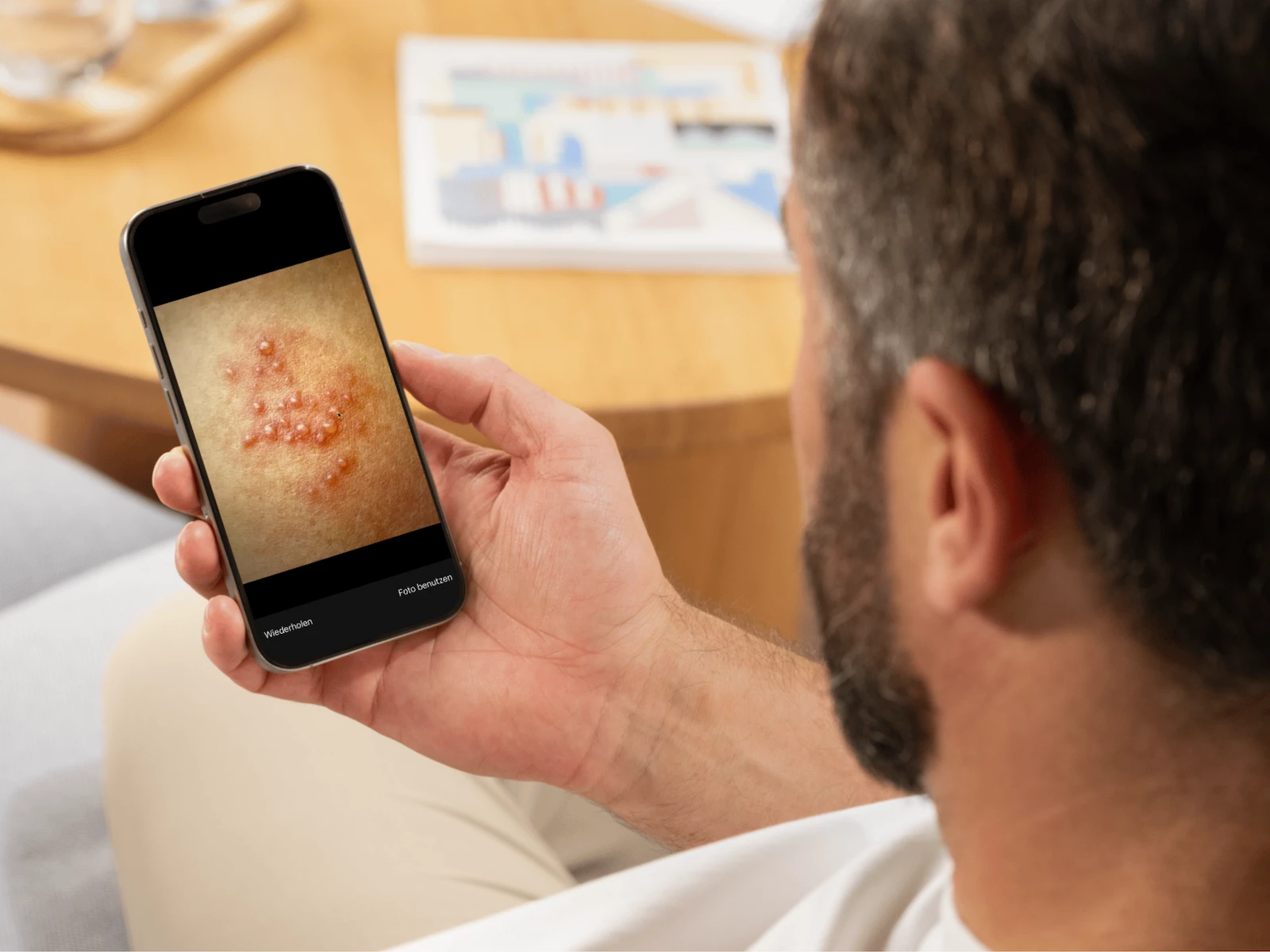 Autoderm KI-Hautanalyse: Innovation bei DocMorris