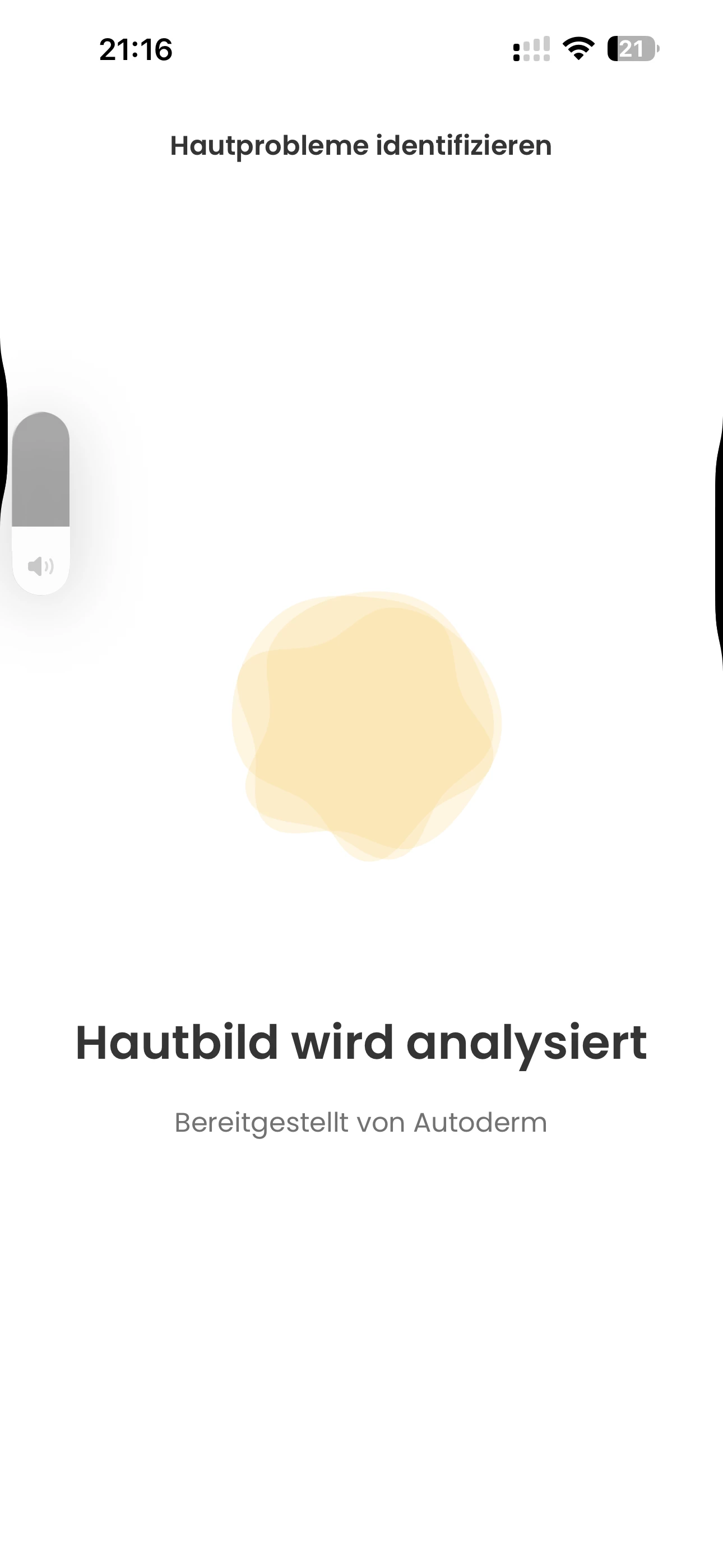 Autoderm KI-Hautanalyse: Innovation bei DocMorris