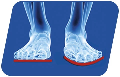 FLEXMED Einlegesohlen: Komfort und Stabilität für gesunde Füße