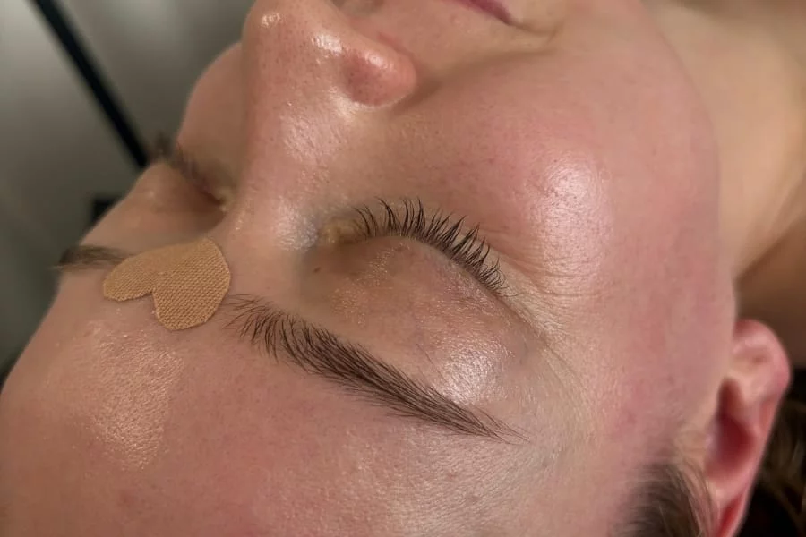 Kobido Massage Berchtesgaden – Japanische Gesichtskunst für natürliche Schönheit
